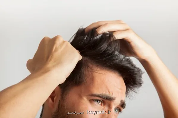 چرا برخی افراد موهای خودرا می کنند؟