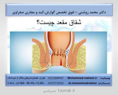 علت درد معده و عوامل تاثیرگذار روی آن