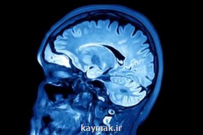 صدمه مغزی عامل زوال عقل در بعضی میانسالان